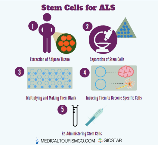 Als Treatment With Stem Cells In Mexico Stem Cells For Mnd Giostar