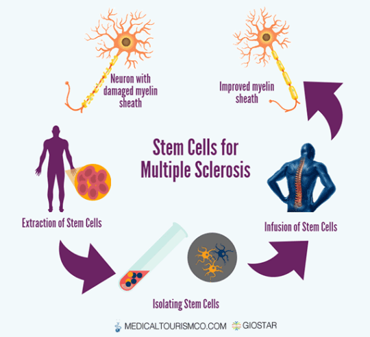 Multiple Sclerosis Stem Cell Therapy In Mexico | Safe, Legal And Quality