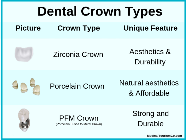 dental crown types