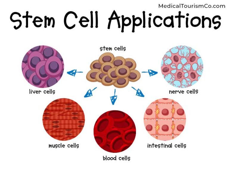 best stem cell treatment in usa
