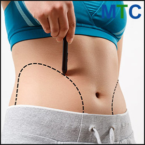Liposuction 360 in Tijuana: Comprehensive Body Contouring with FYA Clinic