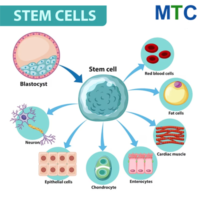 https://www.medicaltourismco.com/wp-content/uploads/2023/08/Stem-cells.jpg