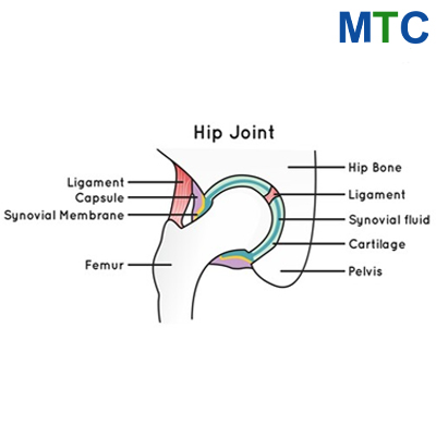 Hip Replacement Surgery in Mexico | Save 80% @ Top Hospitals