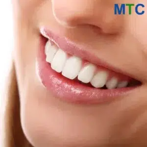 Improve Smile