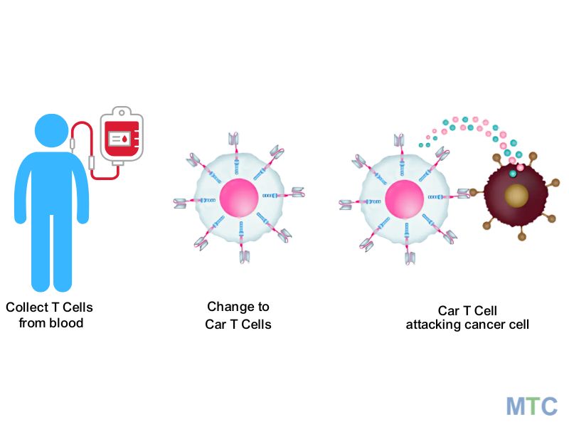 CAR T Cell Therapy Process