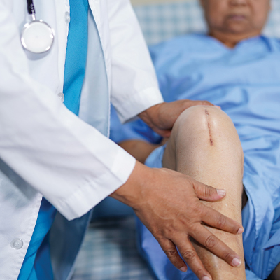 Doctor assessing Knee Replacement patient