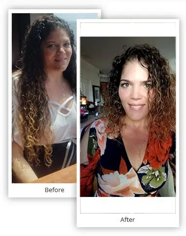 Melonie-Before-After-Bariatric-Surgery