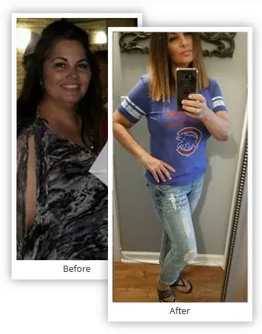 Michelle-Before-After-WLS