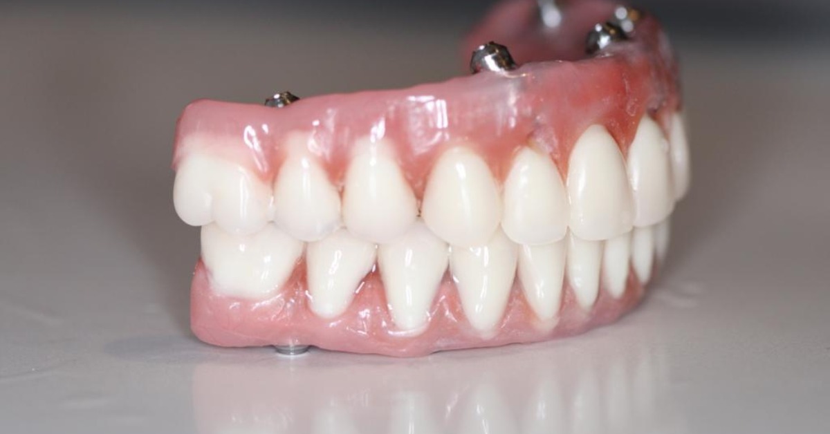 Snap On Dentures in Costa Rica