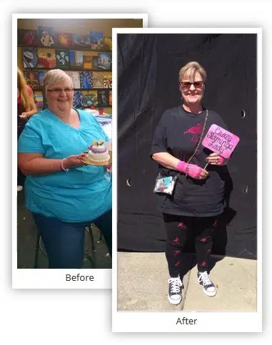 Tammy-Before-After-WLS