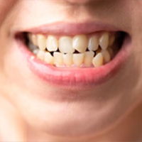 Uneven-teeth