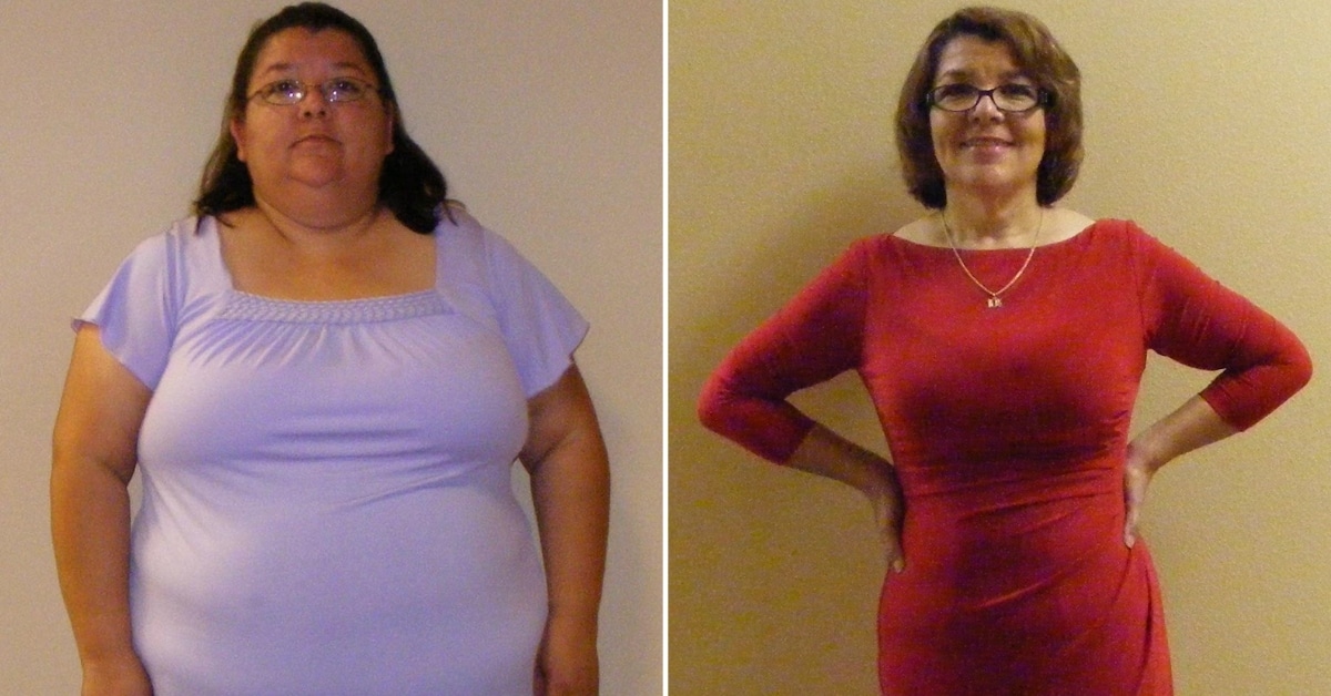 Machelle’s Gastric Sleeve Experience in Mexico