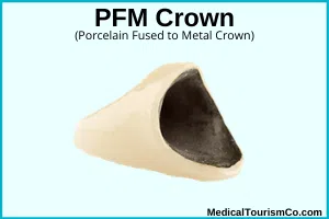 pfm crown