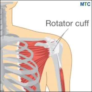 Rotator Cuff