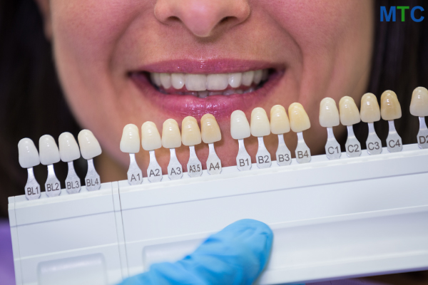 Shade selection for dental veneers