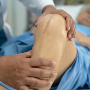 Doctor examining a patient's knee surgery scar