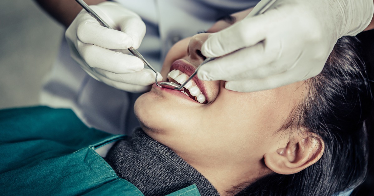 Dental Crowns in Tijuana, Mexico