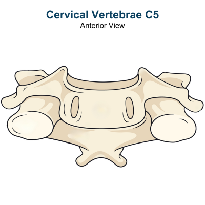 Anterior Cervical Discectomy