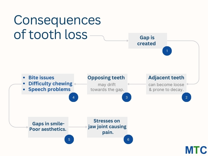 Consequences of Tooth Loss