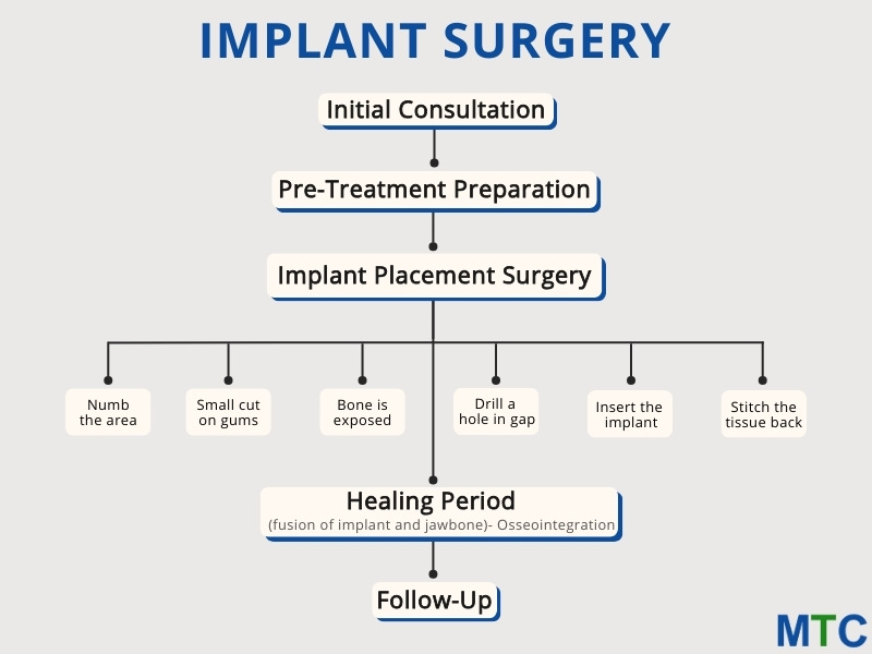 Implant Sugery Steps