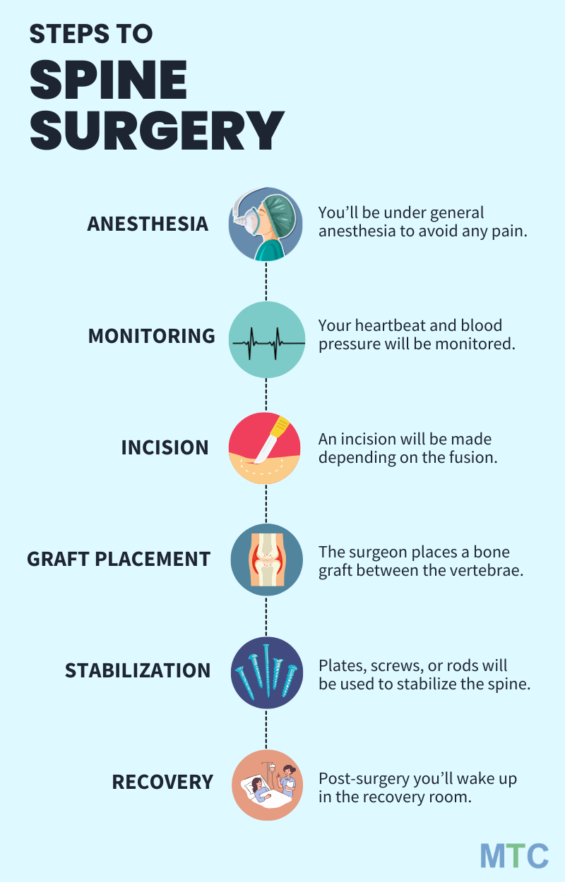 Steps to a Spine Surgery