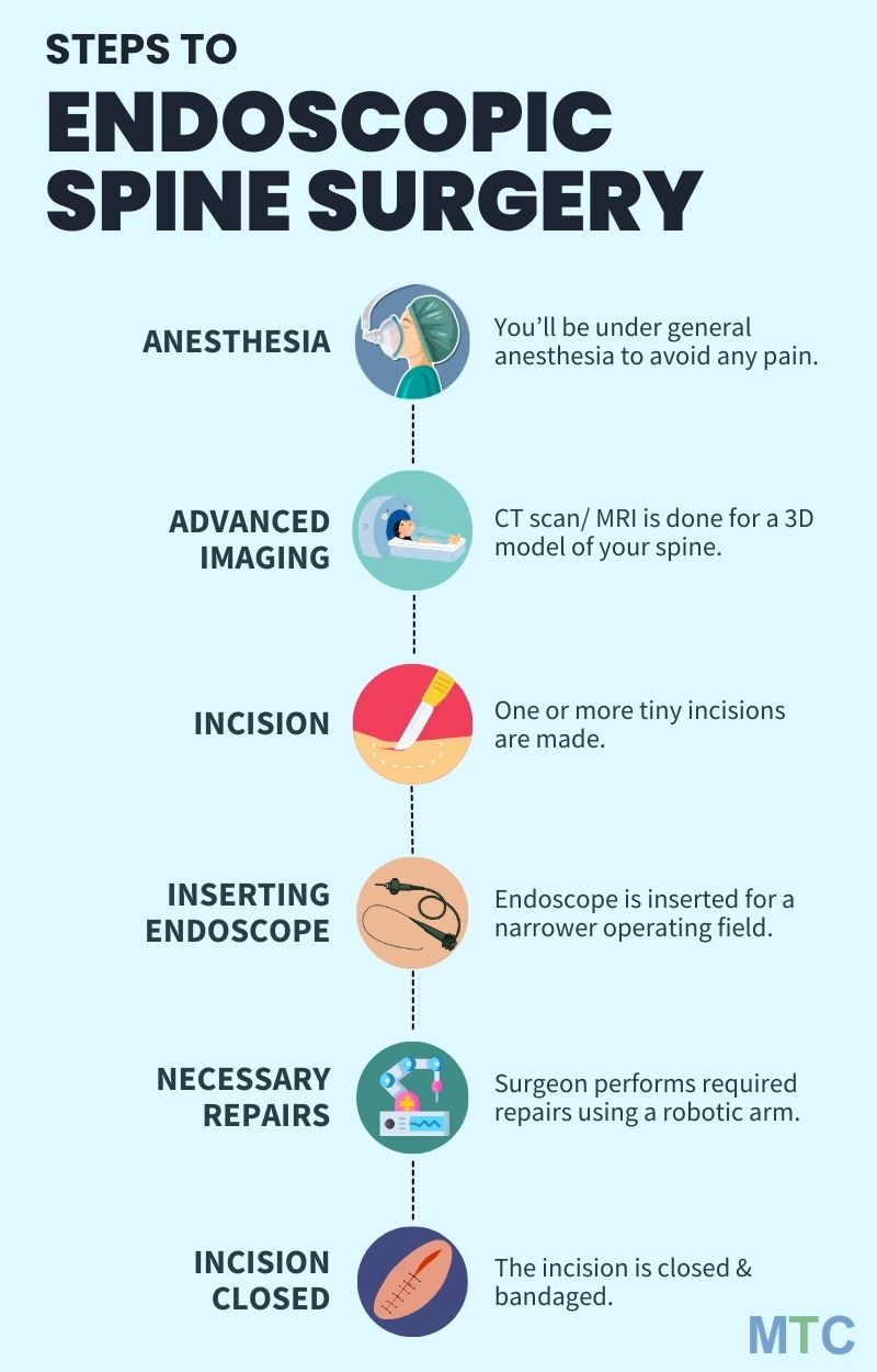 infographic steps to ess