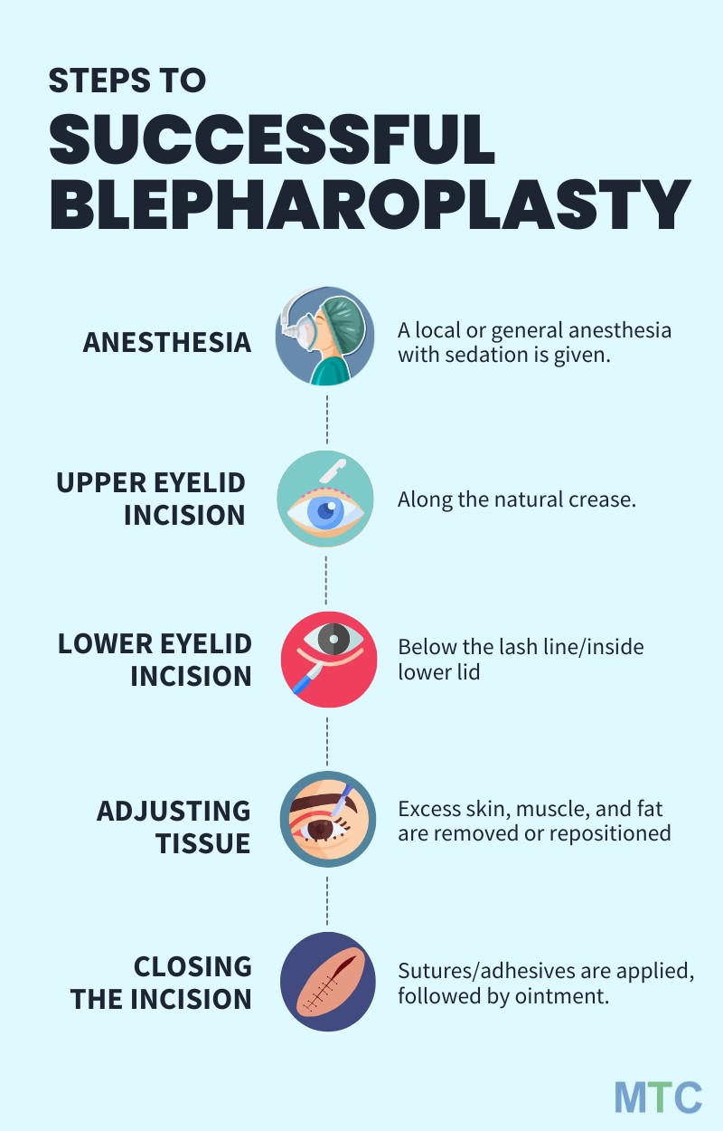 Steps to successful blepharoplasty