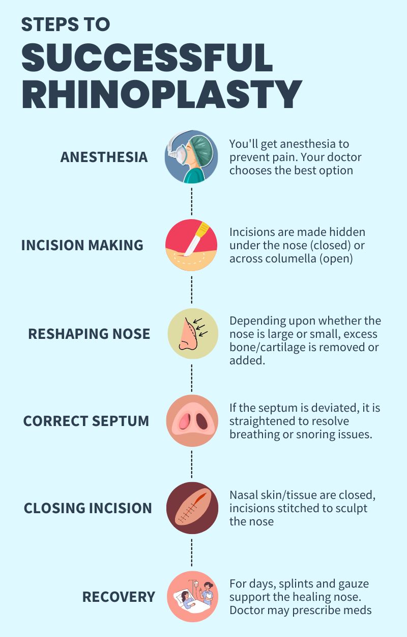 SUCCESSFUL RHINOPLASTY