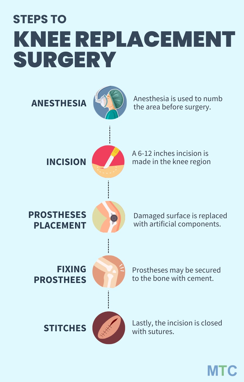 Infographic showing steps to knee replacement surgery