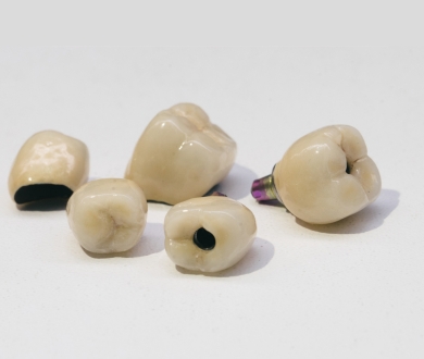 Zirconia Crowns