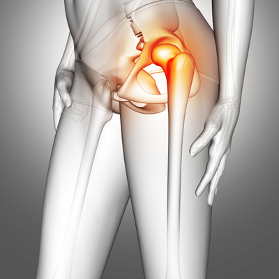 Medical diagram depicting hip pain on one side