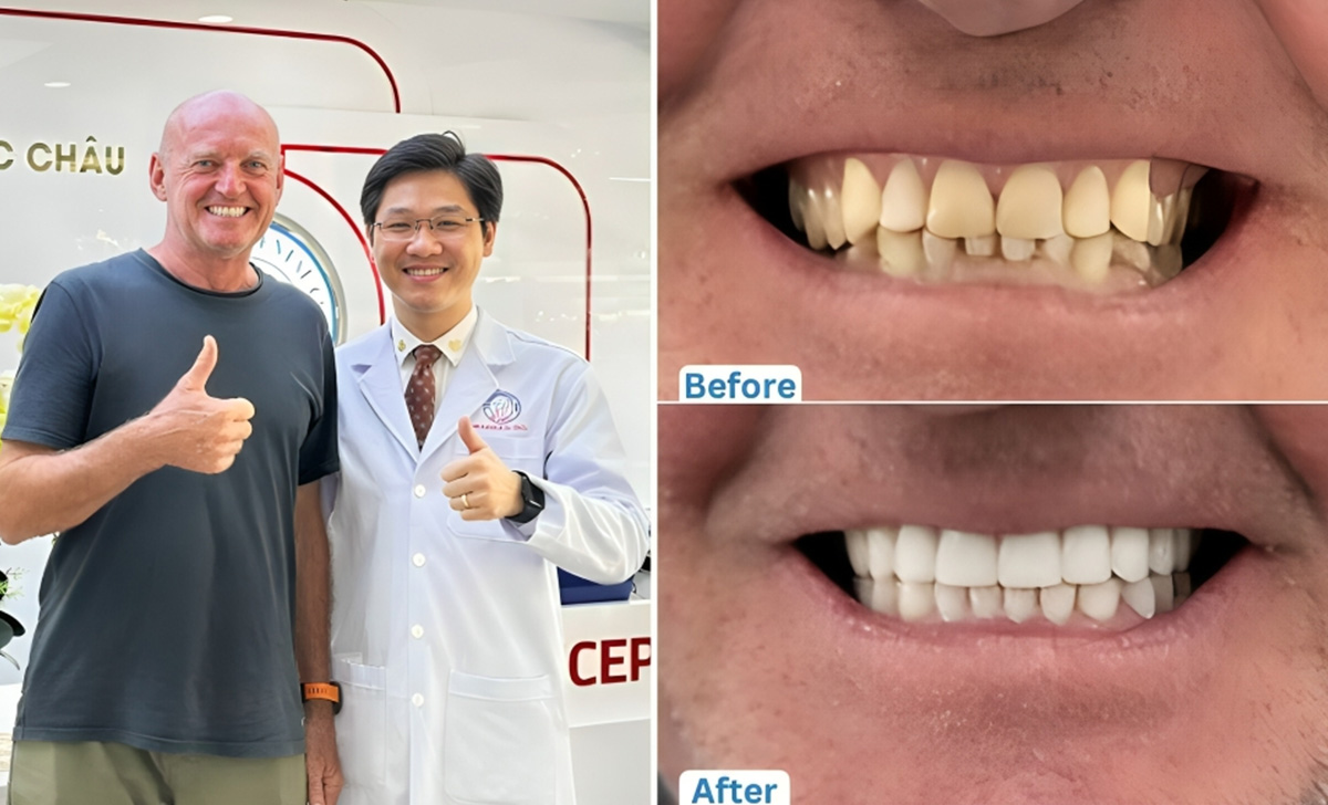 Cosmetic Dentistry in Da Nang