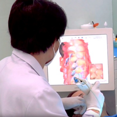 3D dental scan