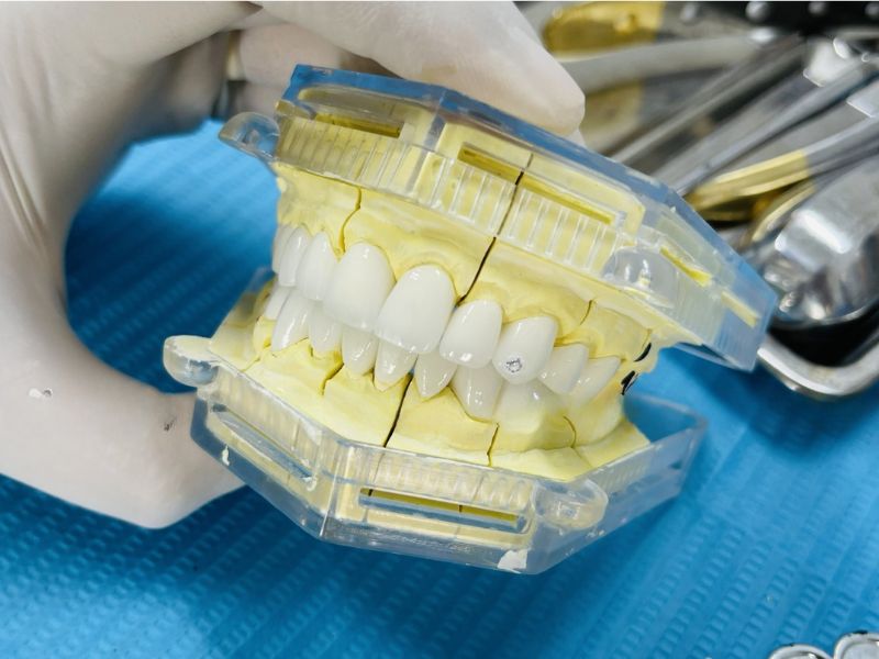 Customized restorations crafted at in-house dental laboratory