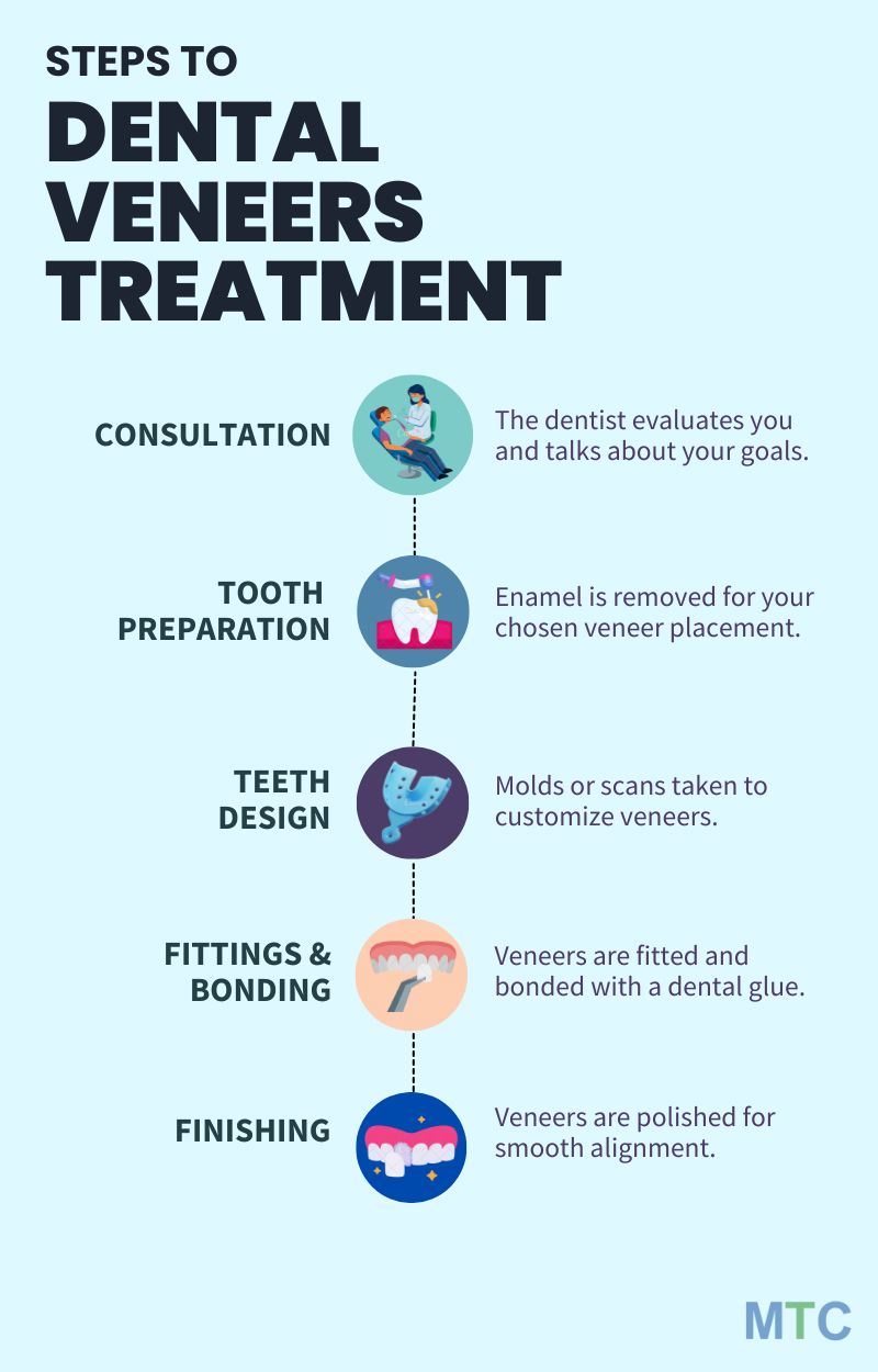 Procedure of Dental Veneers Treatment