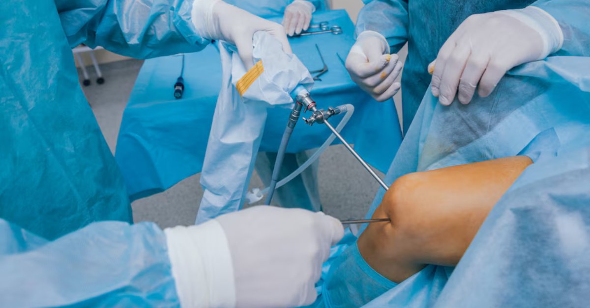 Osteotomy Surgery for the Knee