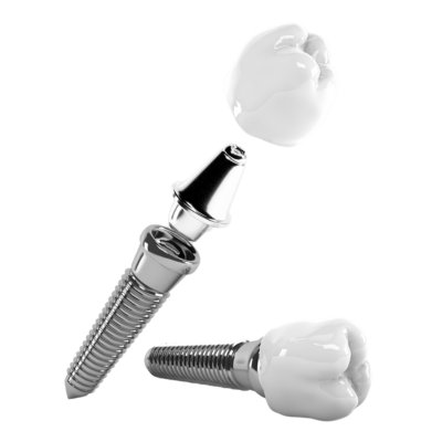 Dental Implants