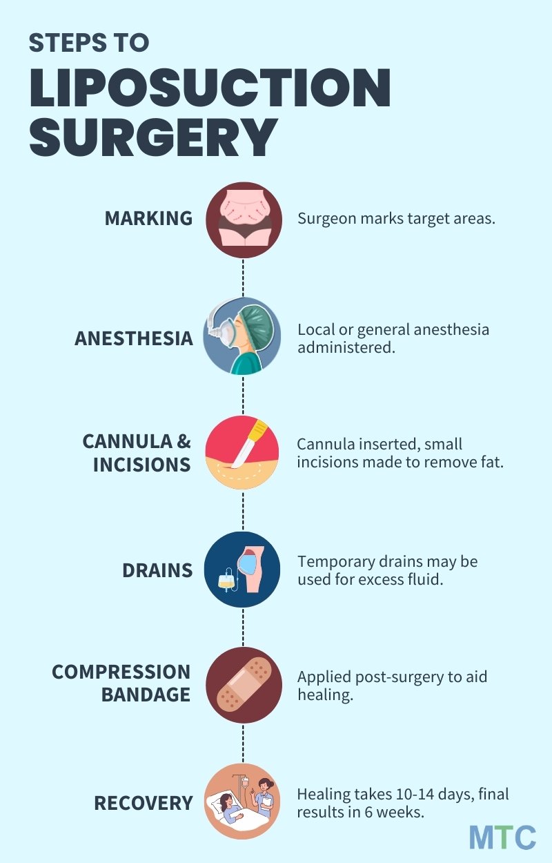 Liposuction Procedure