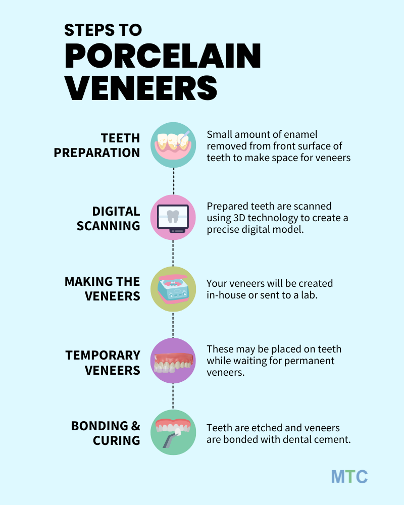 Procedure of porcelain veneers