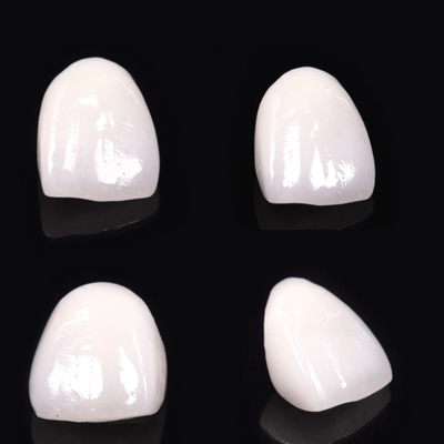 Zirconia Veneers