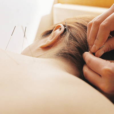 Acupuncture At Our Partner Facility