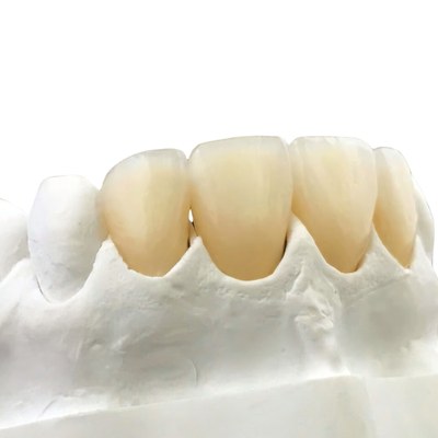 Dental model with zirconia crowns