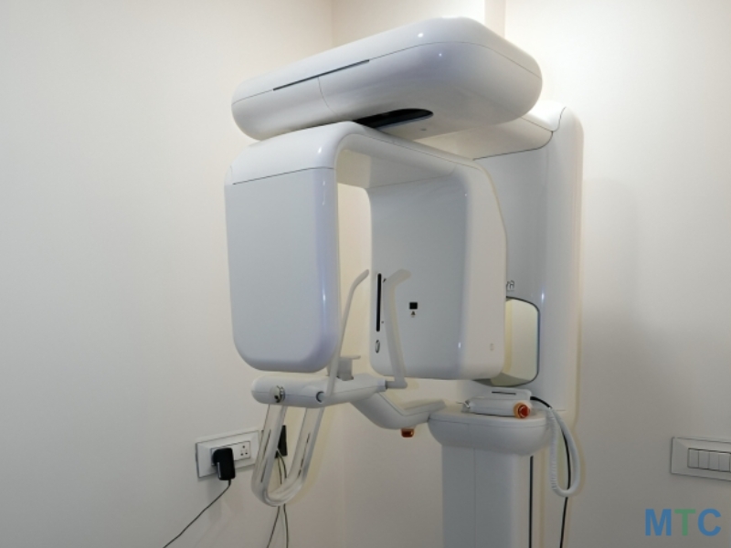 Digital Xray Technology