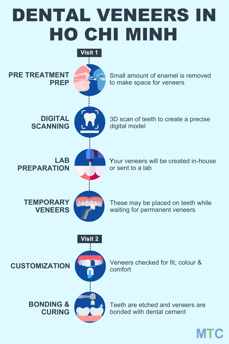 Diagram showing procedure of getting dental veneers in Ho Chi Minh City