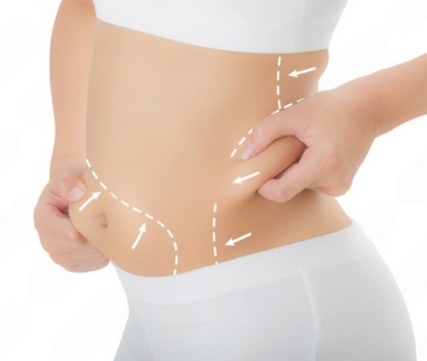 abdomen lipo