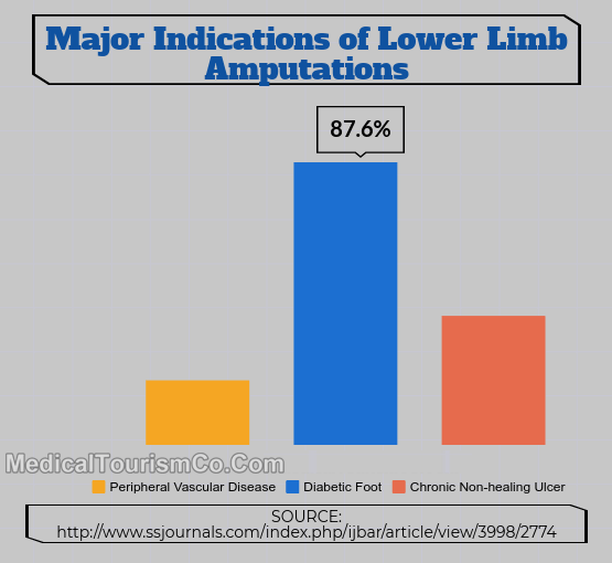 Indications Of Lower Limb Amputation
