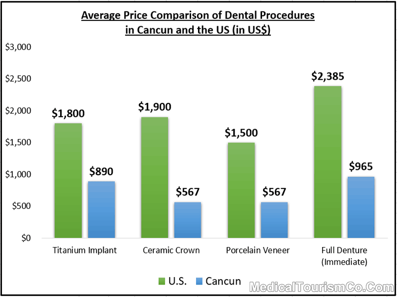 Average Price Comparison of Dental Procedures in Cancun and the US