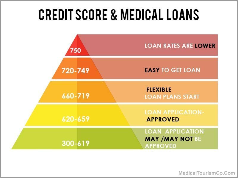 Credit Score for Loan