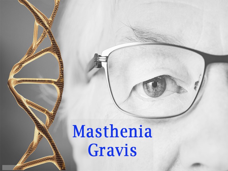 Masthenia Gravis
