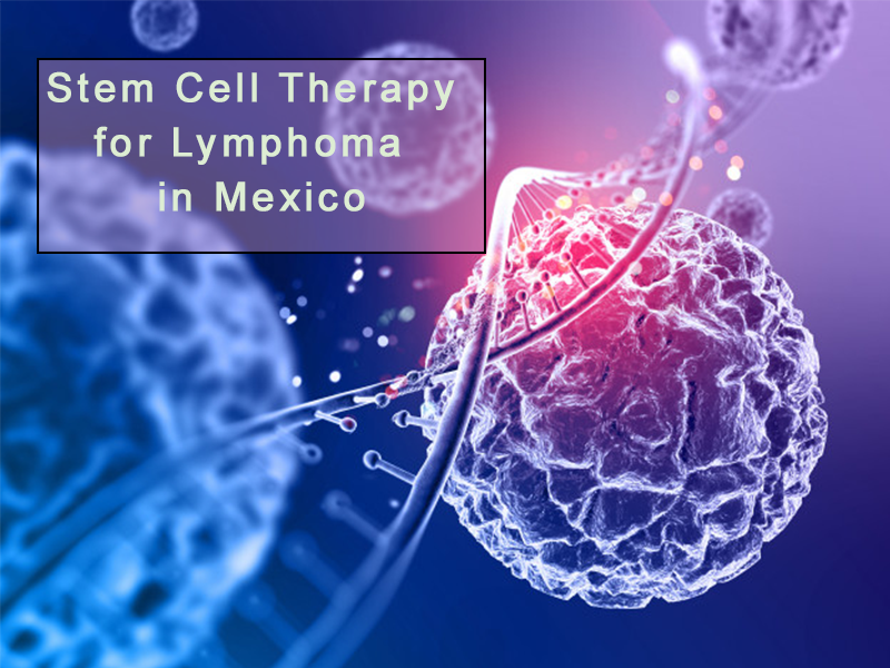 Stem Cell Therapy for Lymphoma in Mexico